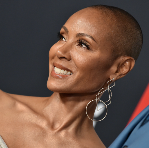 Oscars Controversy Sheds Light on the Struggle of Female Hair Loss Oscars Controversy Sheds Light on the Struggle of Female Hair Loss
